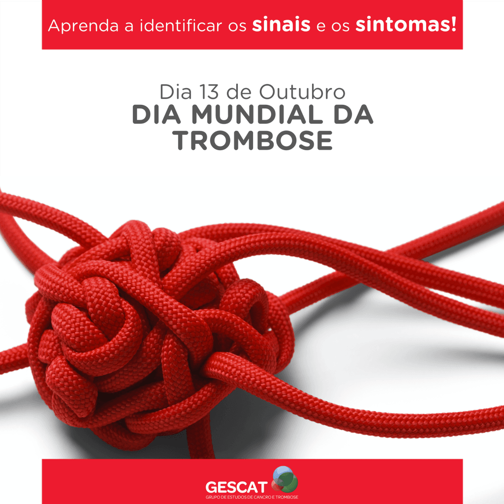 Tromboembolismo venoso: uma doença que afeta 10 milhões em todo o mundo