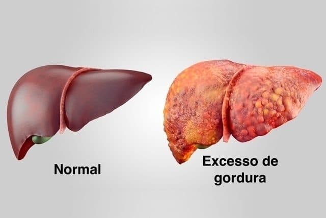 Uma história de maus fígados